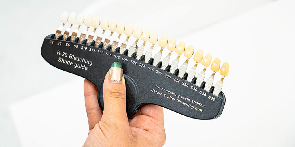 ホワイトニングイメージ